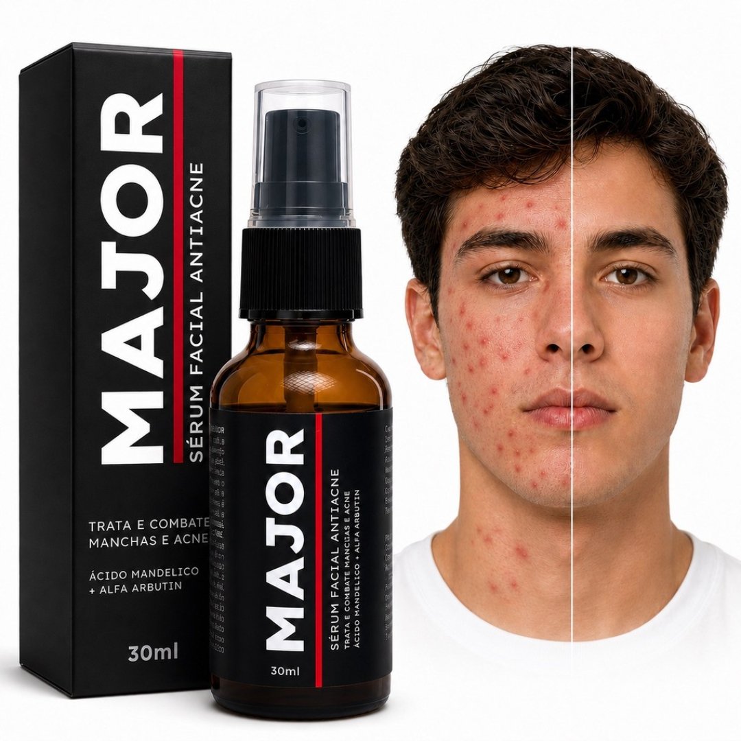 Sérum Antiacne Controle De Oleosidade E Poros 30ml – Major